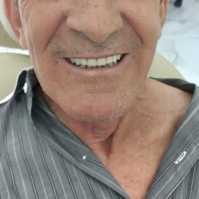 Caso 01, depois do tratamento